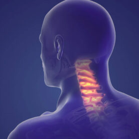 Dolor cervical Dolor cervical