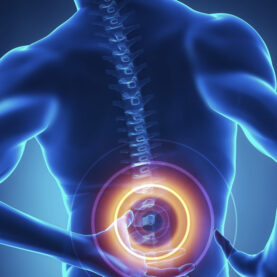 Tratamiento mínimamente invasivo de la raquiestenosis lumbar Tratamiento mínimamente invasivo de la raquiestenosis lumbar