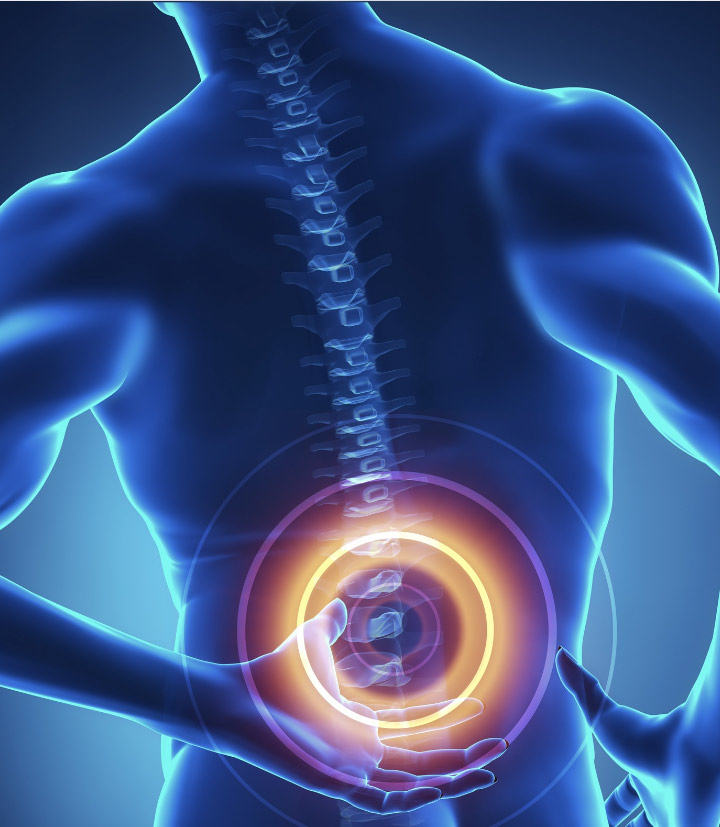 Tratamiento mínimamente invasivo de la raquiestenosis lumbar