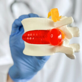 Tratamiento mínimamente invasivo de la hernia discal. Tratamiento mínimamente invasivo de la hernia discal.